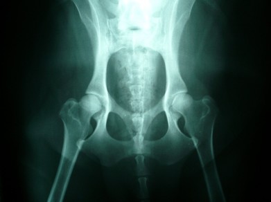 displasia cane